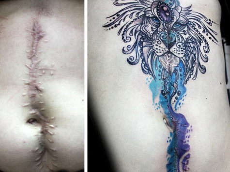 Возможности татуировки на шраме у женщин