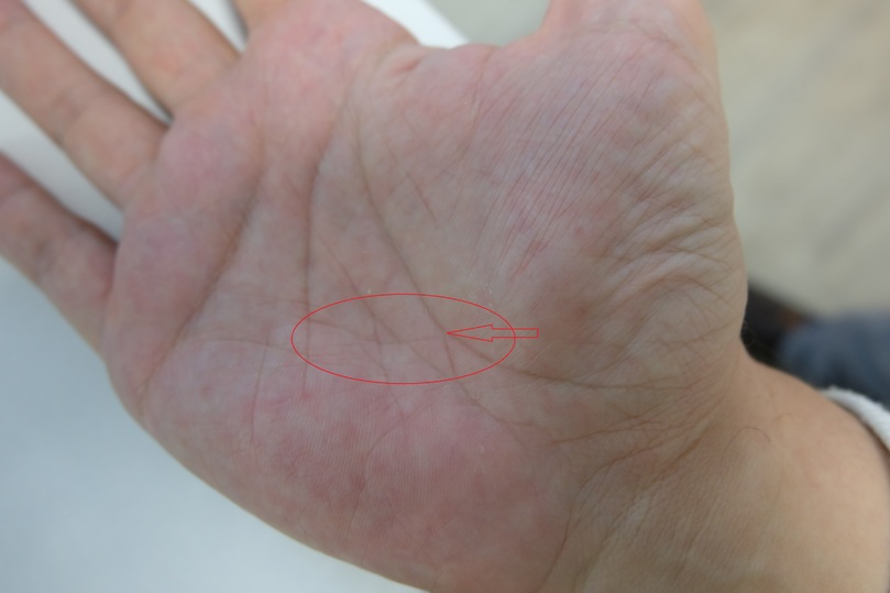 Денежные знаки на руке в хиромантии фото с расшифровкой